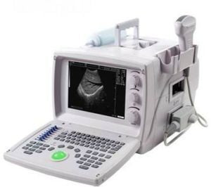 US9618 Portable Ultrasound Scanner with Convex Probe